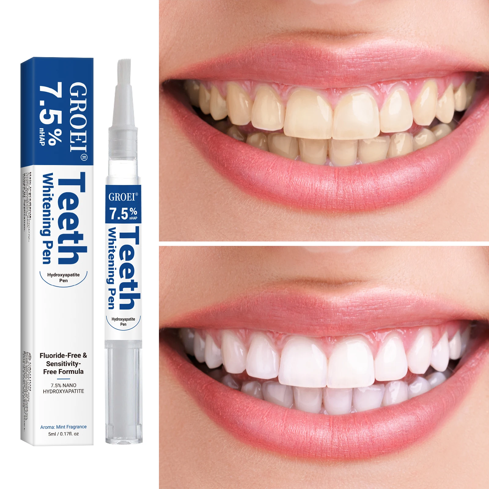 Гидроксипатитовая ручка для от – обзор и цена Teeth Whitening Hydrogen Peroxide