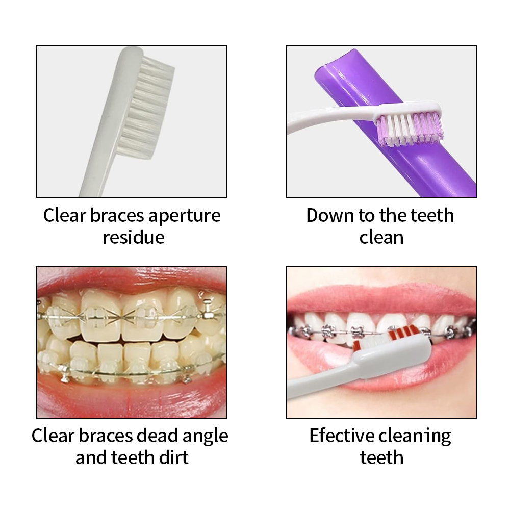 8 шт./компл., набор ортодонтич – обзор и цена Teeth Whitening Brush