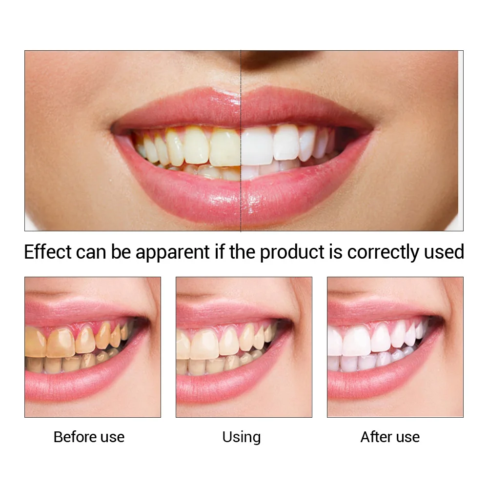 FTEENPLY отбеливание зубов быс – обзор и цена Teeth Whitening Essence