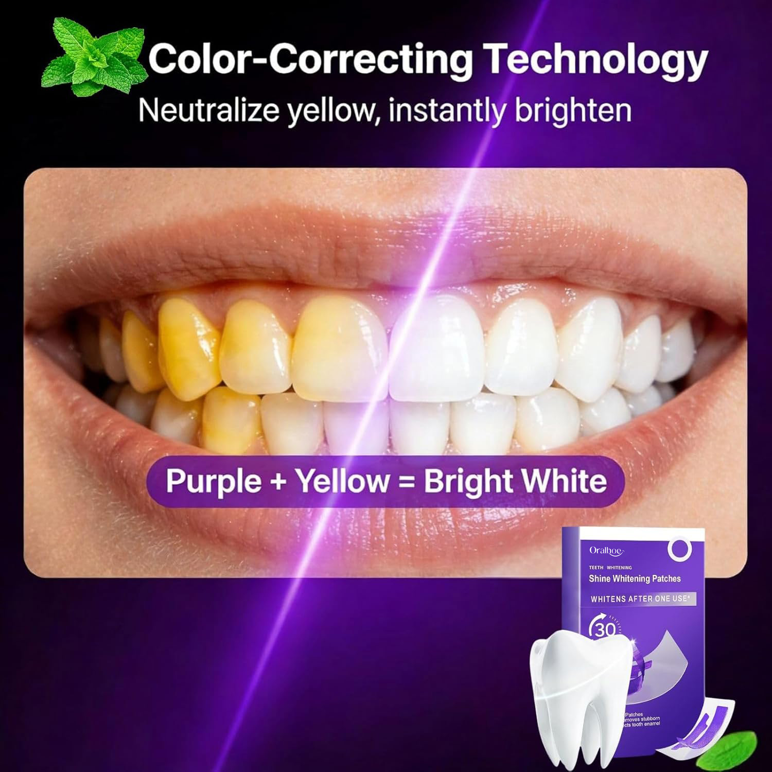 Набор для отбеливания зубов Pu – обзор и цена Teeth Whitening In Office
