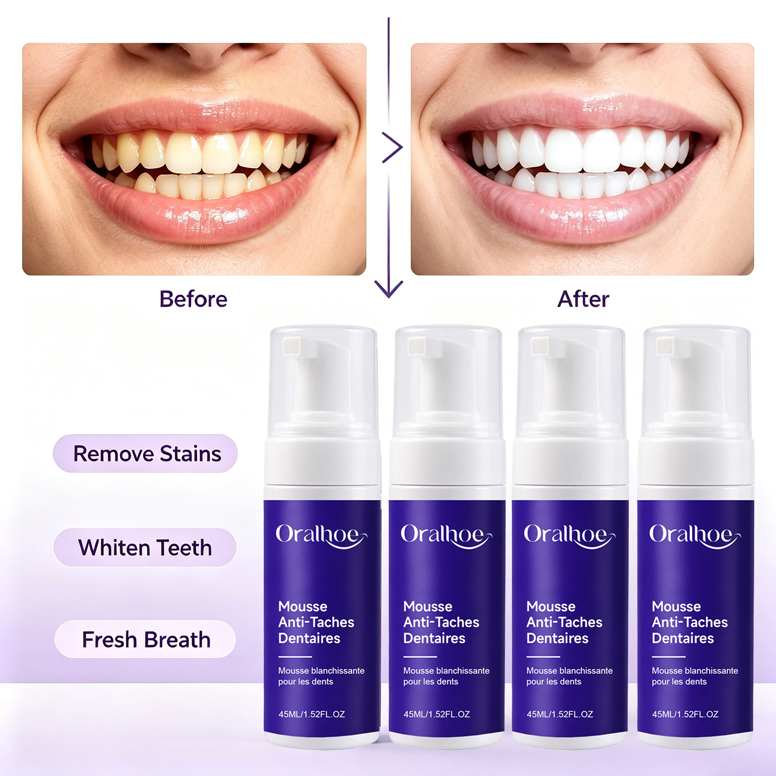 Фиолетовая пенящаяся зубная па – обзор и цена Teeth Whitening Routine