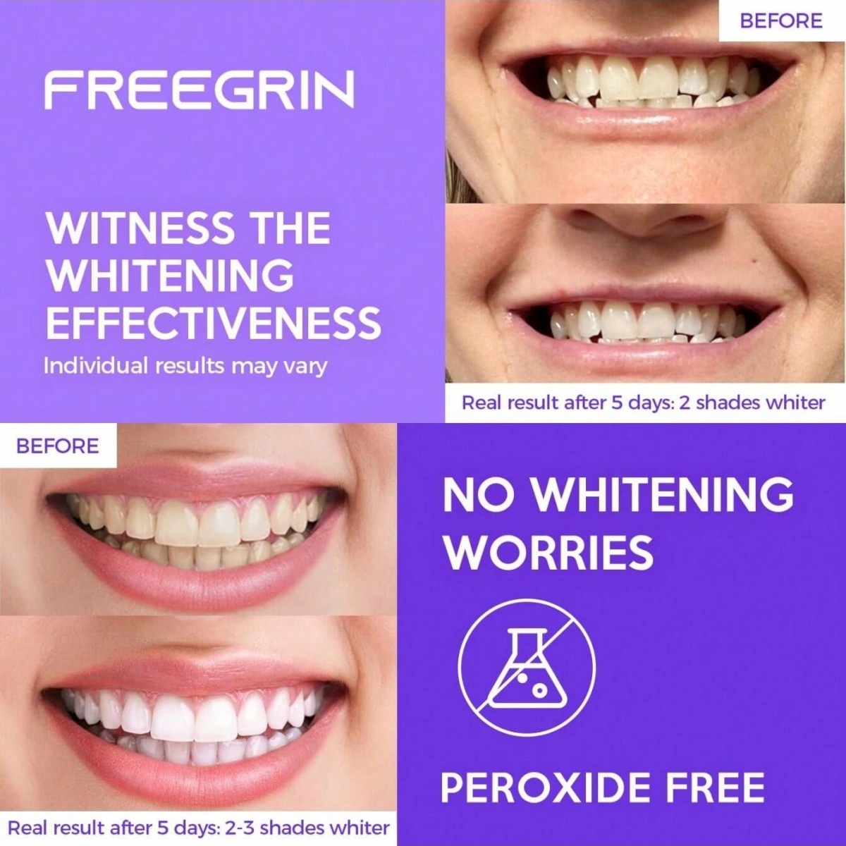 Роскошные отбеливающие наклейк – обзор и цена Teeth Whitening Hydrogen Peroxide